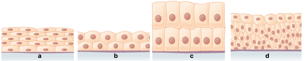 Epiteliu de acoperire pluristratificat: a. pavimentos, b. cubic, c. cilindric, d. de tranziție.